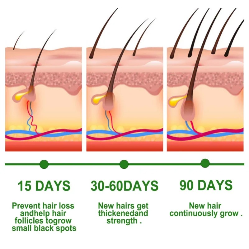 Suero para el crecimiento del  - Hair Care Essence Oil reseña y precio