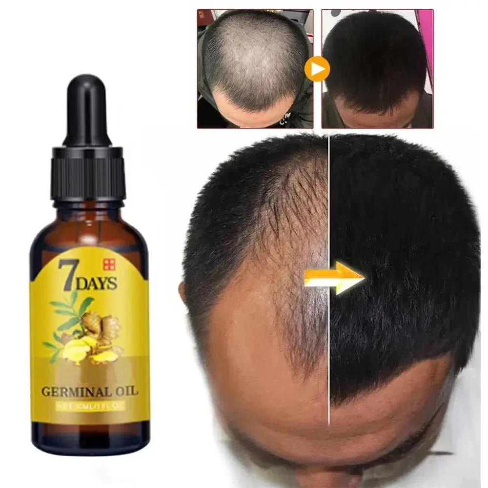 Aceite esencial de jengibre pa - Hair Care Essence Oil reseña y precio